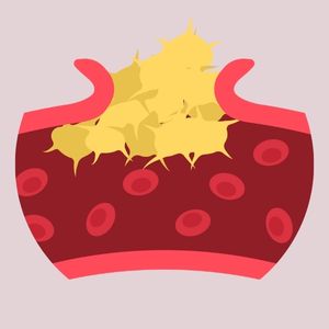 THROMBOPHILIA PROFILE ADVANCE